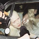 Static Dress CD Injury Episode