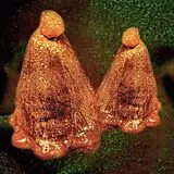 Black To Comm Vinyl Oocyte Oil & Stolen Androgens