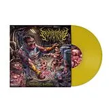 Embryectomy Vinyl Vitriolic Baptism