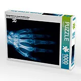 CALVENDO Puzzle Röntgenbild von einem Handknochen. | 1000 Teile Lege-Größe 64x48cm Foto-Puzzle für glückliche Stunden Spiel
