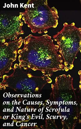 E-Book (epub) Observations on the Causes, Symptoms, and Nature of Scrofula or King's Evil, Scurvy, and Cancer von John Kent