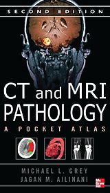 eBook (pdf) CT &amp; MRI Pathology: A Pocket Atlas, Second Edition de Michael Grey, Jagan Ailinani