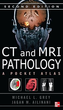 eBook (pdf) CT &amp; MRI Pathology: A Pocket Atlas, Second Edition de Michael Grey, Jagan Ailinani