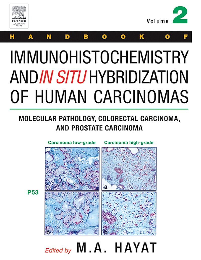 Handbook of Immunohistochemistry and in Situ Hybridization of Human Carcinomas