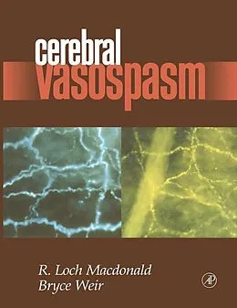 E-Book (pdf) Cerebral Vasospasm von R. Loch Macdonald, Bruce Weir