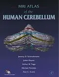 E-Book (pdf) MRI Atlas of the Human Cerebellum von Jeremy D. Schmahmann, Julien Doyon, Michael Petrides