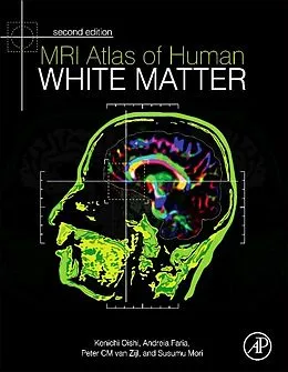 E-Book (pdf) MRI Atlas of Human White Matter von Kenichi Oishi, Andreia V. Faria, Peter C M van Zijl