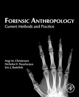 E-Book (epub) Forensic Anthropology von Angi M. Christensen, Nicholas V. Passalacqua, Eric J. Bartelink