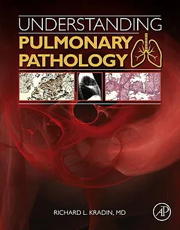 E-Book (epub) Understanding Pulmonary Pathology von Richard L. Kradin
