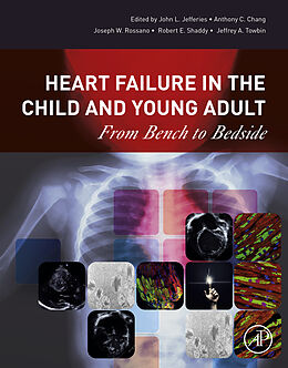 eBook (epub) Heart Failure in the Child and Young Adult de 