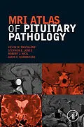 E-Book (pdf) MRI Atlas of Pituitary Pathology von Ecnu Pantalone DO, Stephen E. Jones, Robert J. Weil