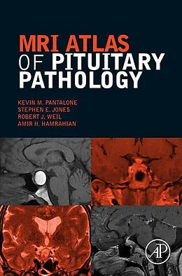E-Book (pdf) MRI Atlas of Pituitary Pathology von Ecnu Pantalone DO, Stephen E. Jones, Robert J. Weil