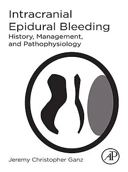 E-Book (epub) Intracranial Epidural Bleeding von Jeremy Christopher Ganz