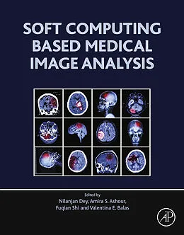 E-Book (epub) Soft Computing Based Medical Image Analysis von Nilanjan Dey, Amira S. Ashour, Fuquian Shi