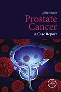 E-Book (epub) Prostate Cancer von Gilles Plourde