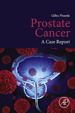 E-Book (epub) Prostate Cancer von Gilles Plourde