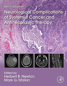 eBook (pdf) Neurological Complications of Systemic Cancer and Antineoplastic Therapy de 