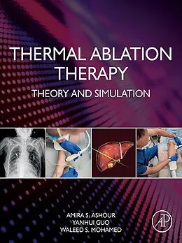 E-Book (epub) Thermal Ablation Therapy von Amira S. Ashour, Yanhui Guo, Waleed S. Mohamed