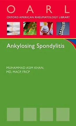 E-Book (epub) Ankylosing Spondylitis von Muhammad Asim Khan