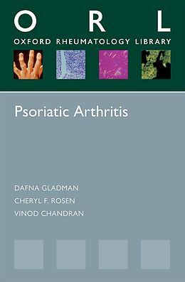 E-Book (epub) Psoriatic Arthritis von Dafna Gladman, Cheryl F. Rosen, Vinod Chandran