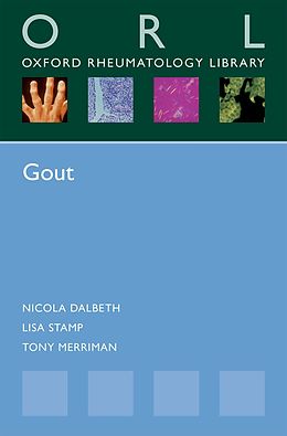 eBook (epub) Gout de Nicola Dalbeth, Lisa Stamp, Tony Merriman
