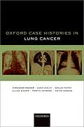 E-Book (pdf) Oxford Case Histories in Lung Cancer von Himender K. Makker, Adam Ainley, Sanjay Popat