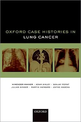 E-Book (epub) Oxford Case Histories in Lung Cancer von Himender K. Makker, Adam Ainley, Sanjay Popat