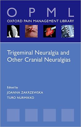 eBook (pdf) Trigeminal Neuralgia and Other Cranial Neuralgias de 