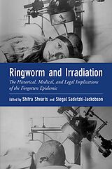 eBook (epub) Ringworm and Irradiation de Shifra Shvarts, Siegal Sadetzki