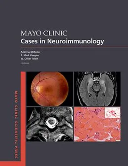 PDF Mayo Clinic Cases in Neuroimmunology von Andrew McKeon, B. Mark Keegan, W. Oliver Tobin
