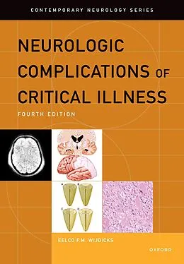 E-Book (epub) Neurologic Complications of Critical Illness von Eelco F. M. Wijdicks