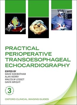 Couverture cartonnée Practical Perioperative Transoesophageal Echocardiography de 