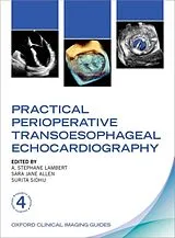 Kartonierter Einband Practical Perioperative Transoesophageal Echocardiography von 