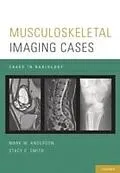 E-Book (pdf) Musculoskeletal Imaging Cases von Mark W. Anderson, Stacy E. Smith