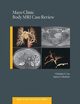 PDF Mayo Clinic Body MRI Case Review von Christine U. C. Lee, James Glockner