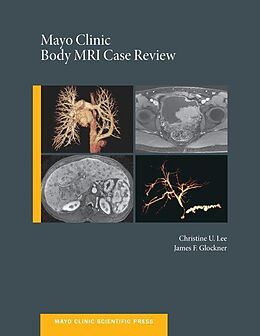 E-Book (epub) Mayo Clinic Body MRI Case Review von Christine U. C. Lee, James Glockner