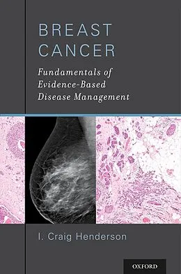 E-Book (pdf) Breast Cancer von I. Craig MD Henderson