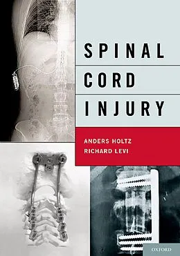E-Book (pdf) Spinal Cord Injury von Md Holtz, Md Levi