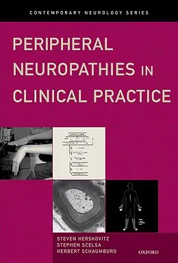 E-Book (pdf) Peripheral Neuropathies in Clinical Practice von Steven Herskovitz, Stephen Scelsa, Herbert Schaumburg