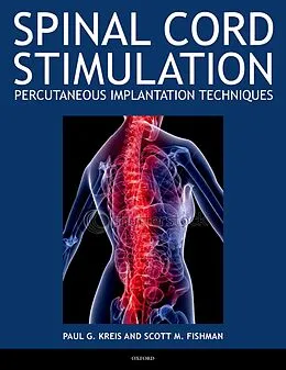 E-Book (pdf) Spinal Cord Stimulation von Paul Kreis, Scott Fishman