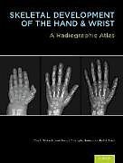 Skeletal Development of the Hand and Wrist