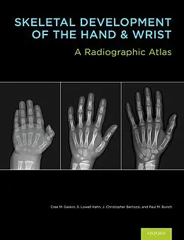 E-Book (pdf) Skeletal Development of the Hand and Wrist von Cree M. Gaskin, S. Lowell Kahn, J. Christoper Bertozzi
