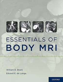 E-Book (pdf) Essentials of Body MRI von William E. Brant, Eduard E. de Lange