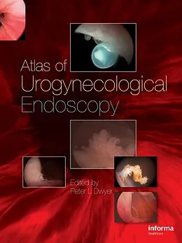 E-Book (pdf) Atlas of Urogynecological Endoscopy von Peter L. Dwyer