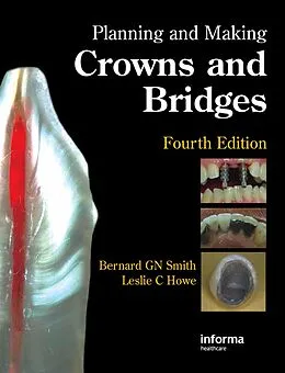 E-Book (pdf) Planning and Making Crowns and Bridges von Bernard G. N. Smith, Leslie C. Howe