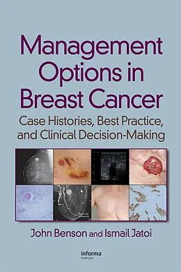 PDF Management Options in Breast Cancer von John Benson, Ismail Jatoi