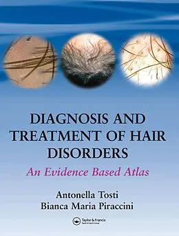 E-Book (pdf) Diagnosis and Treatment of Hair Disorders von Antonella Tosti, Bianca Maria Piraccini