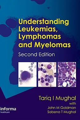 E-Book (pdf) Understanding Leukemias, Lymphomas and Myelomas von Tariq I. Mughal, Tariq Mughal, John Goldman