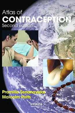 E-Book (pdf) Atlas of Contraception von Pramilla Senanayake, Malcolm Potts