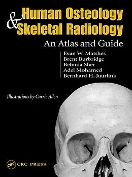 E-Book (pdf) Human Osteology and Skeletal Radiology von Evan W. Matshes, Bernard Juurlink